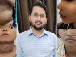 एपेक्स में निरंतर हो रही विशिष्ट सफल हेड एंड नेक कैंसर सर्जरी