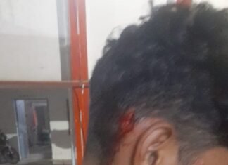 रामलीला देखने गए दो पक्षों में जमकर हुईं मारपीट