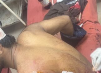 मिर्जापुर,क्रिकेट मैच को लेकर चला चाकू तीन घायल
