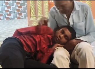 कुत्ते के काटने के बाद अधूरी वैक्सीन, युवक में रेबीज के लक्षण से हड़कंप