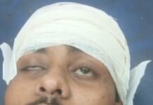 छात्र नेता विकास केसरवानी पर जानलेवा हमला, वाराणसी रेफर