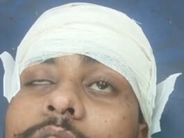 छात्र नेता विकास केसरवानी पर जानलेवा हमला, वाराणसी रेफर