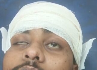 छात्र नेता विकास केसरवानी पर जानलेवा हमला, वाराणसी रेफर
