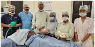 25 वर्षीय महिला के पेट से निकाला गया विशाल ट्यूमर