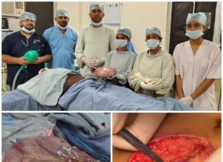 25 वर्षीय महिला के पेट से निकाला गया विशाल ट्यूमर